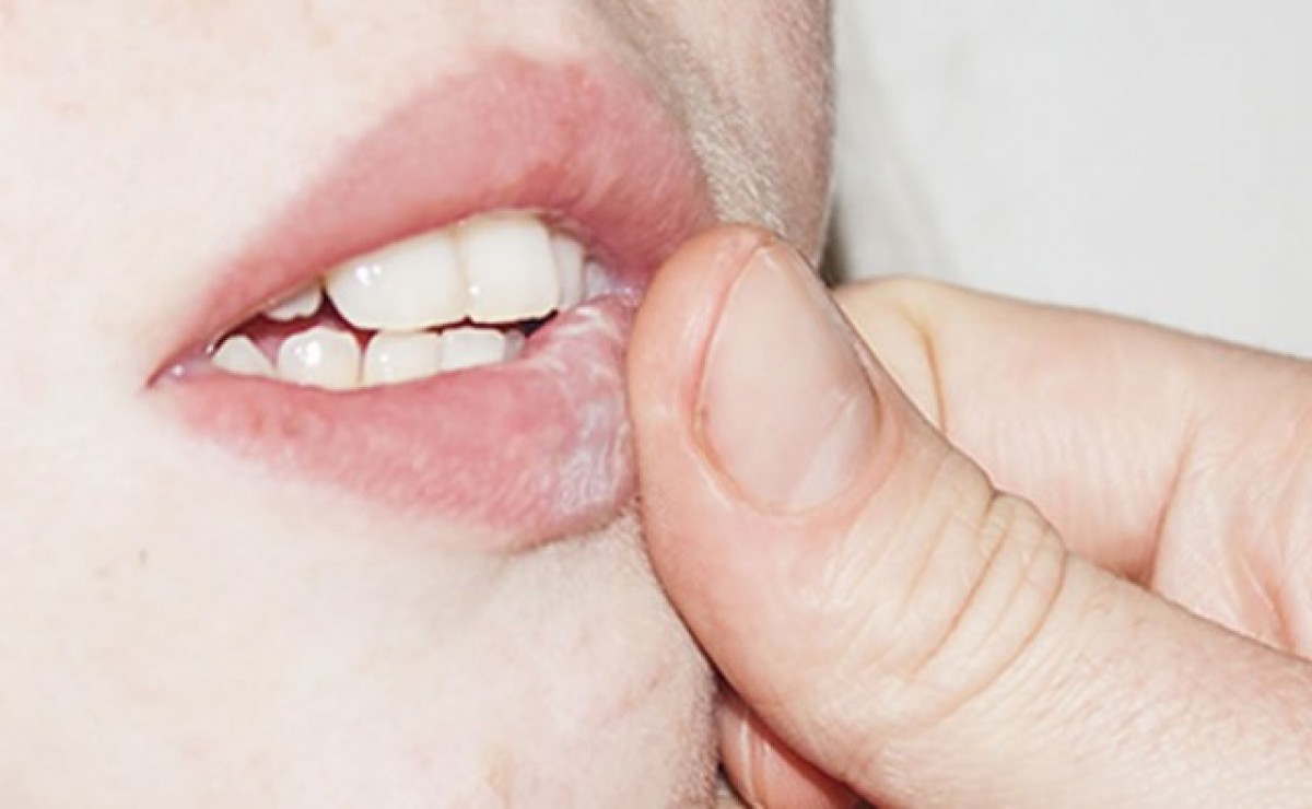 Imatge il·lustrativa