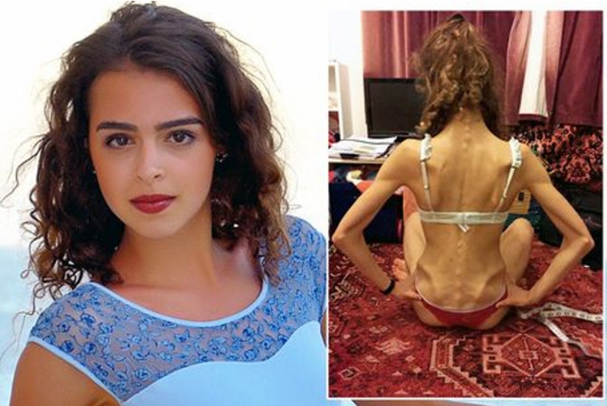 Imatge il·lustrativa