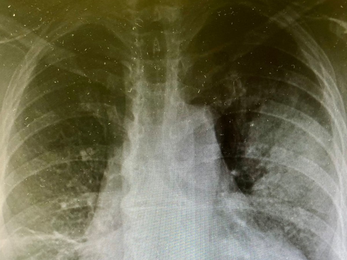 Imatge il·lustrativa