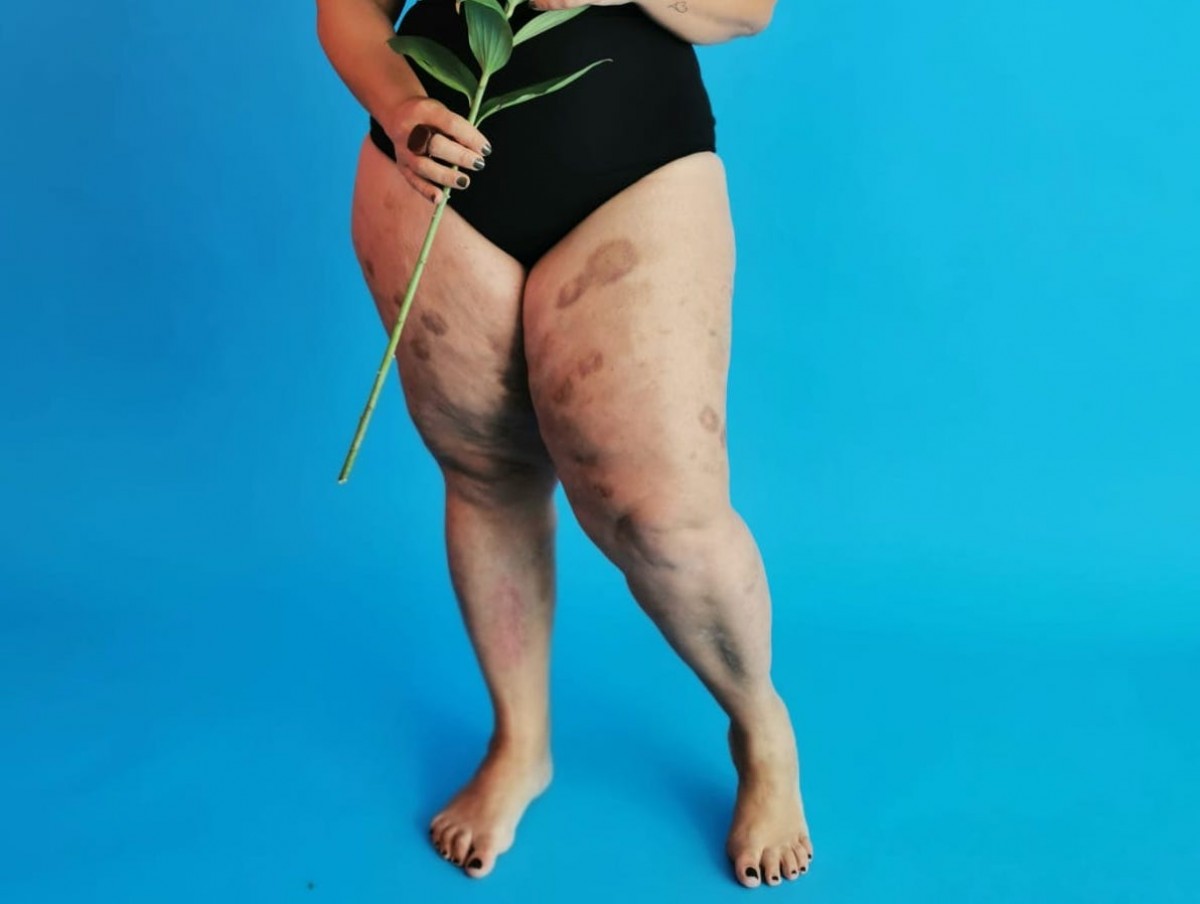 Imatge il·lustrativa